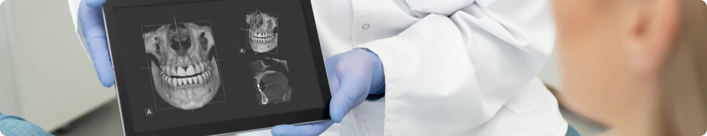 A dental professional wearing gloves holds a tablet displaying 3D dental X-ray images while consulting with a patient.
