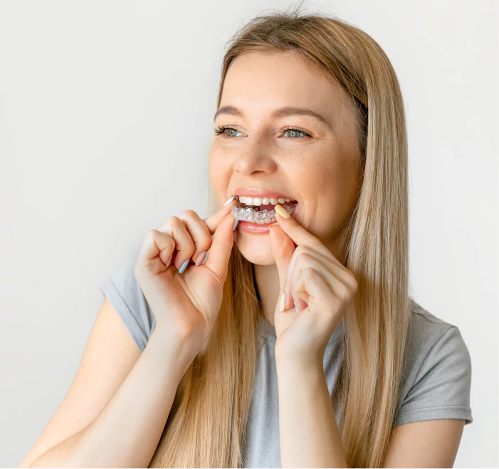 Clear Aligners